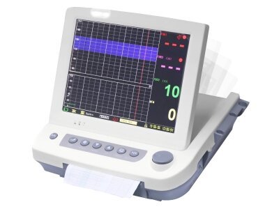 SK-EM006 MONITOR - SAIKANG MEDICAL
